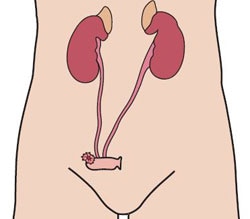 Urostomía