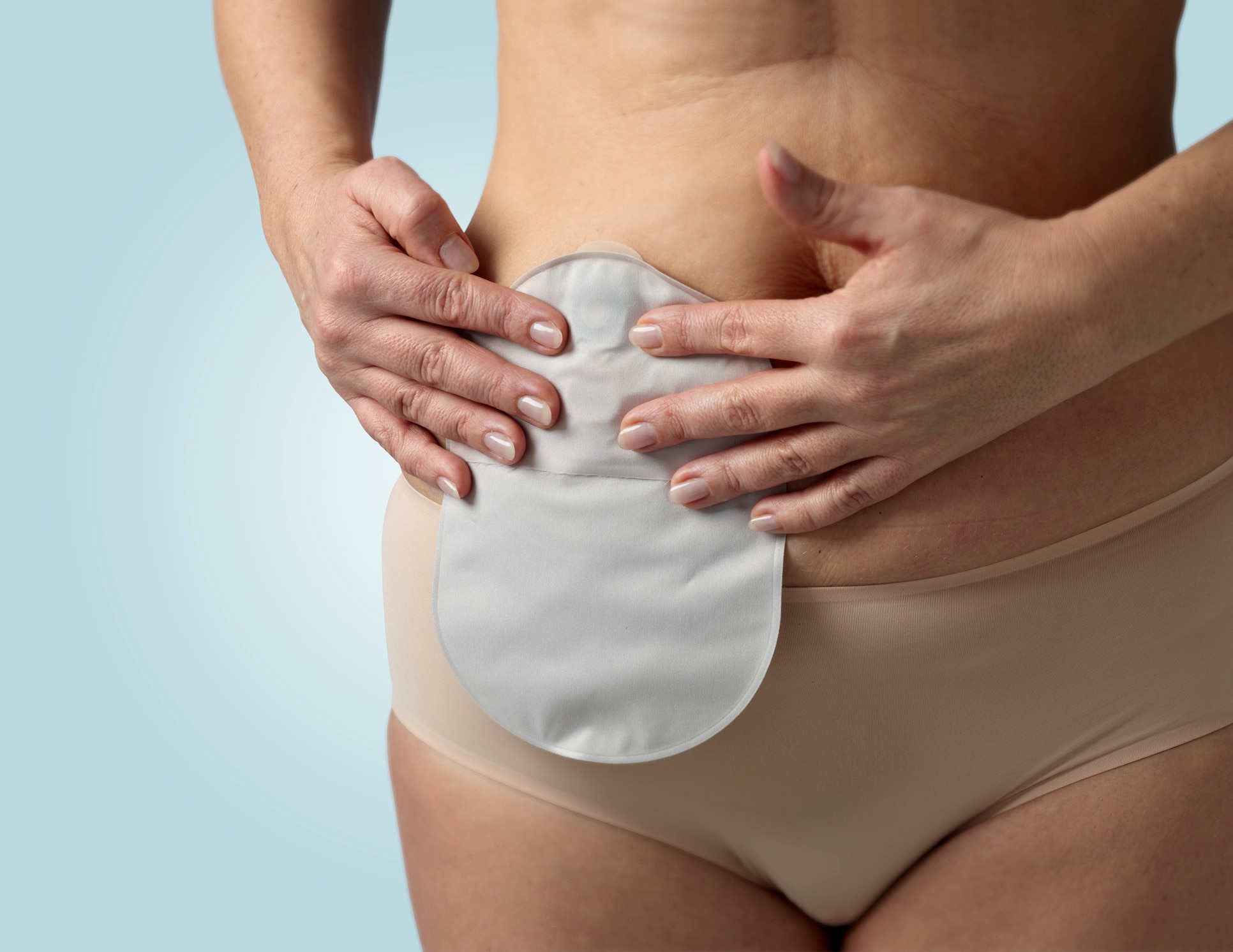 ¿Por qué necesito usar una bolsa de ostomía? 