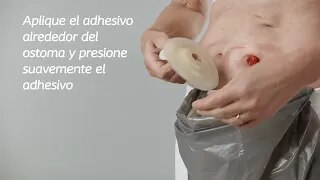 SenSura ® Mio Convex – Acople click Bolsa Abierta 