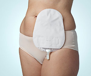 SenSura Mio Bolsa para Urostomías
